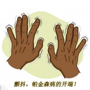 顫抖，帕金森病的開端 帕金森的癥狀有哪些
